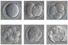 为什么俄罗斯试管婴儿都采用囊胚移植呢?