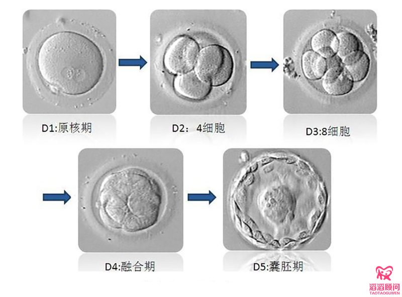  试管婴儿的胚胎分级