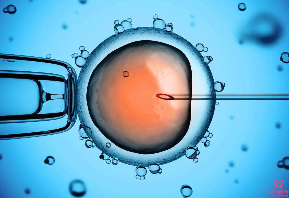 单精子注射技术(ICSI)