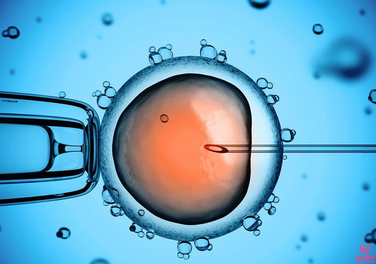 卵胞浆内单精子显微注射（ICSI）