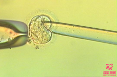 俄罗斯三代试管PGT-M、PGT-SR、PGT-A技术详解，让您不再两眼一抹黑。